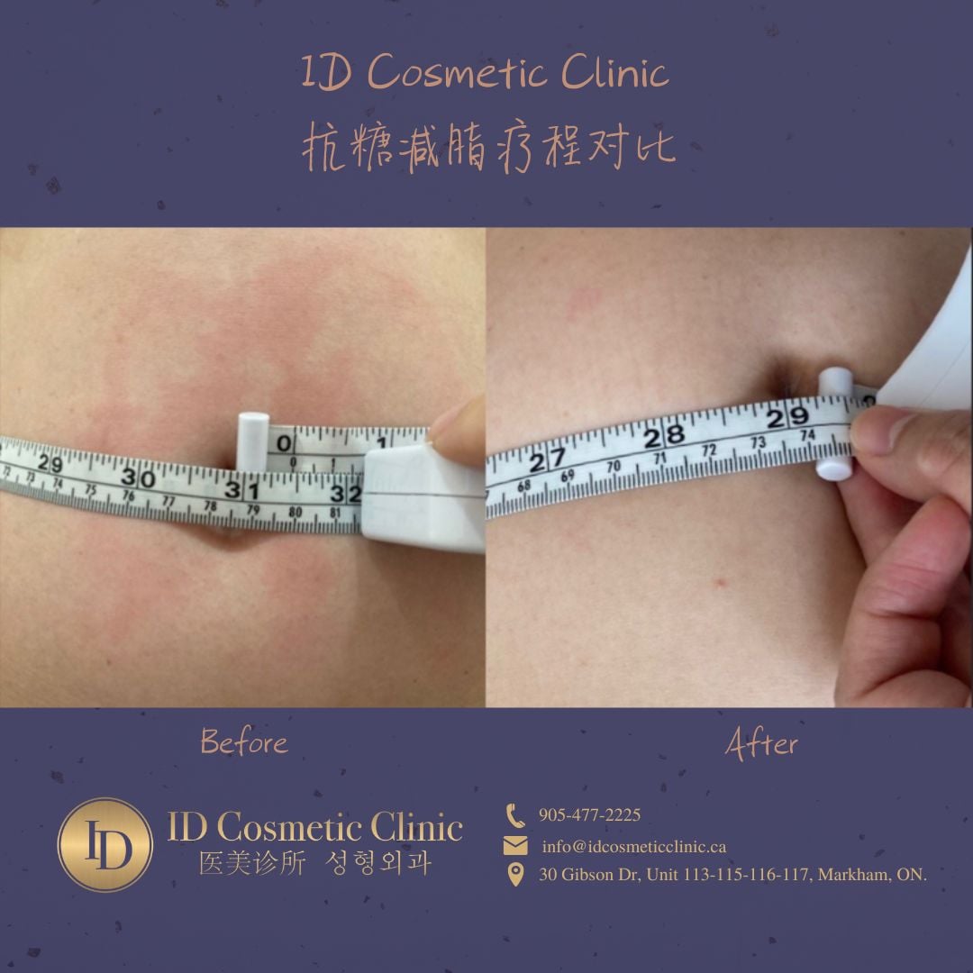 JingHuang抗糖减脂对比