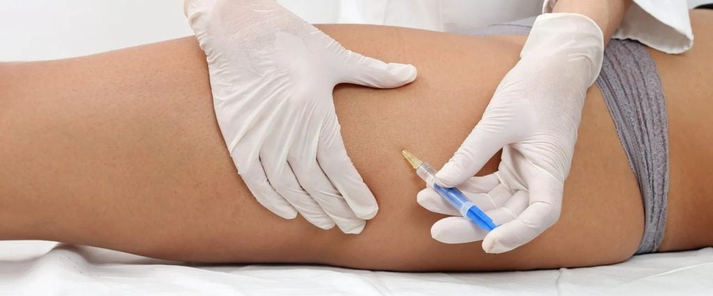 lipotropic injections near me lipotropic injections in Markham at ID Cosmetic Clinic