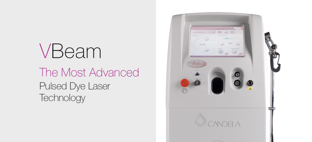VBeam Laser Treatment Stock