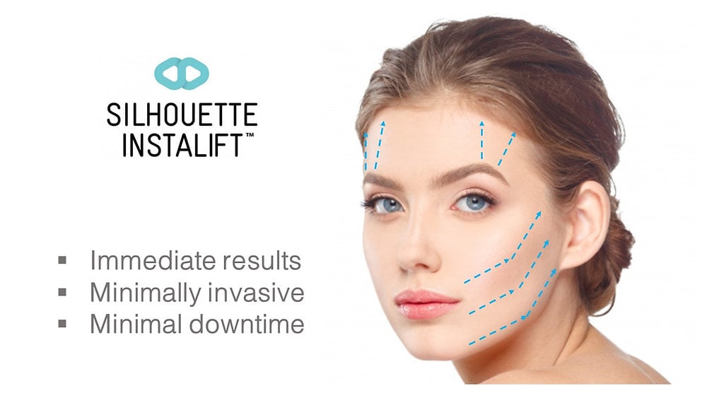 Silhouette InstaLift