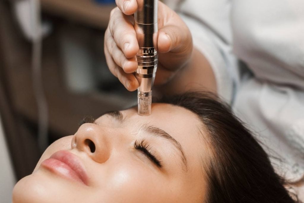 microneedling toronto