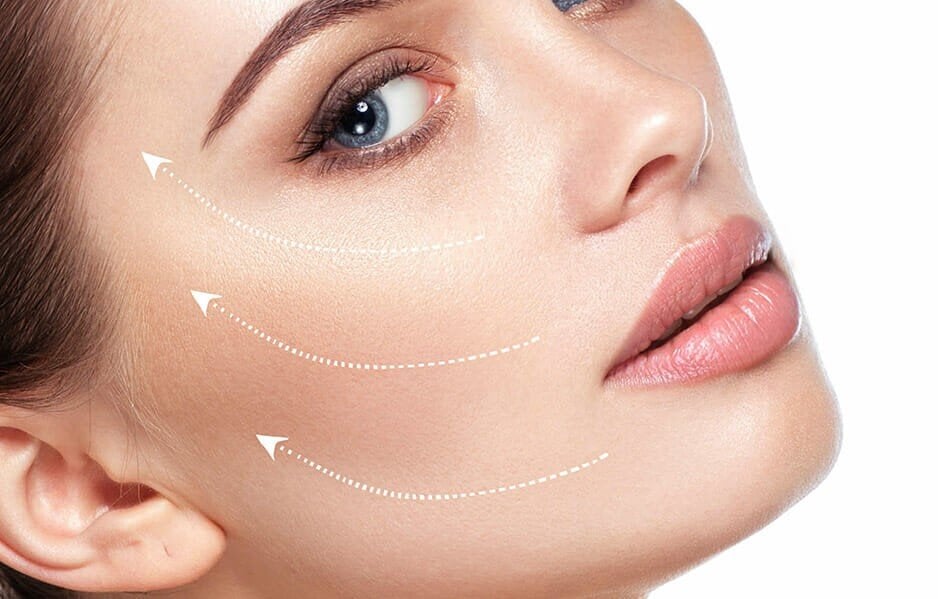 Silhouette InstaLift