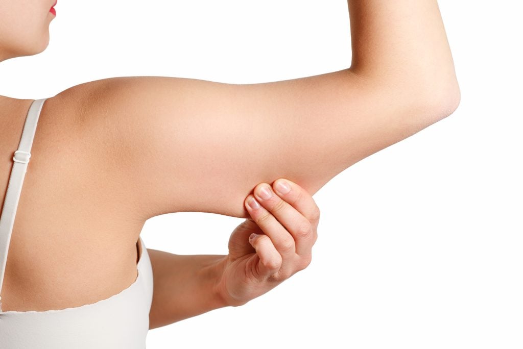 arm fat removal