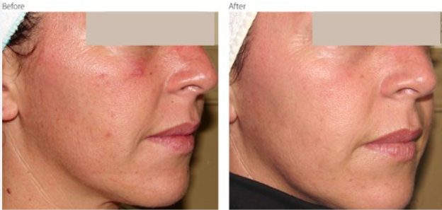 m22 彩光 多伦多