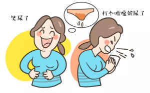 产后漏尿 漏尿治疗 多伦多