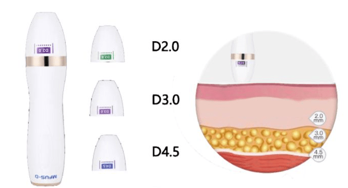 超声炮 超声刀 多伦多