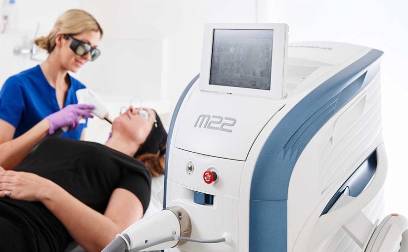 玫瑰痤疮 激光治疗 M22