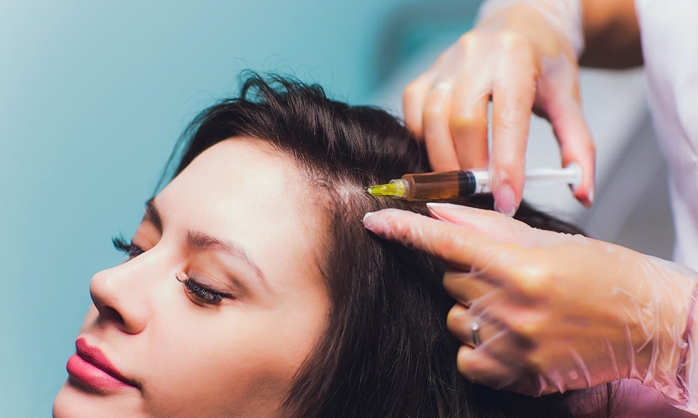 PRP Hair Treatment Liverpool