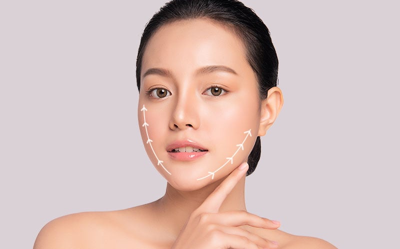 线雕提拉 1 线雕提拉