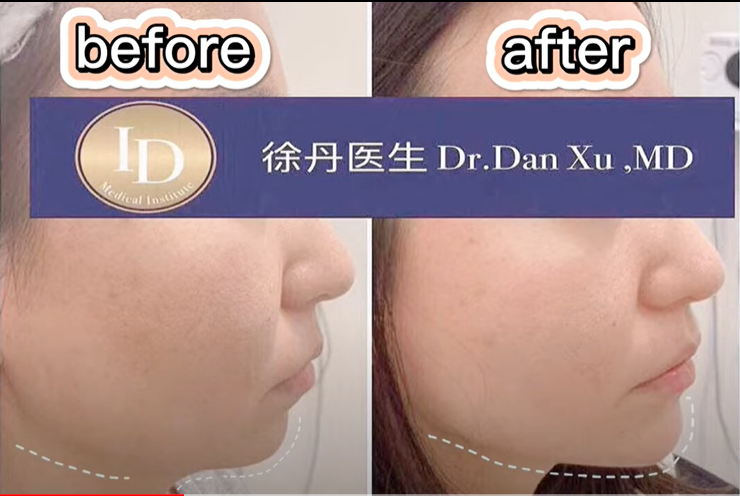 骨相塑型 多伦多