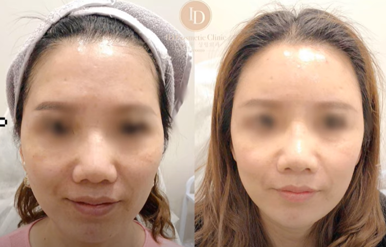 骨相塑形 多伦多