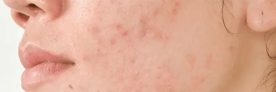 知识分享 194 v2 e44bf0ed6783fc6301282e190736d239 1440w 1